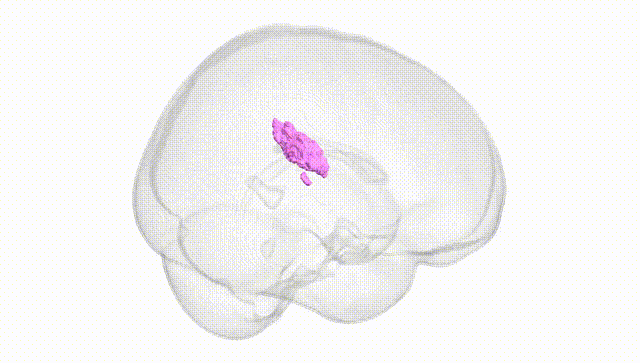 Full Brain White