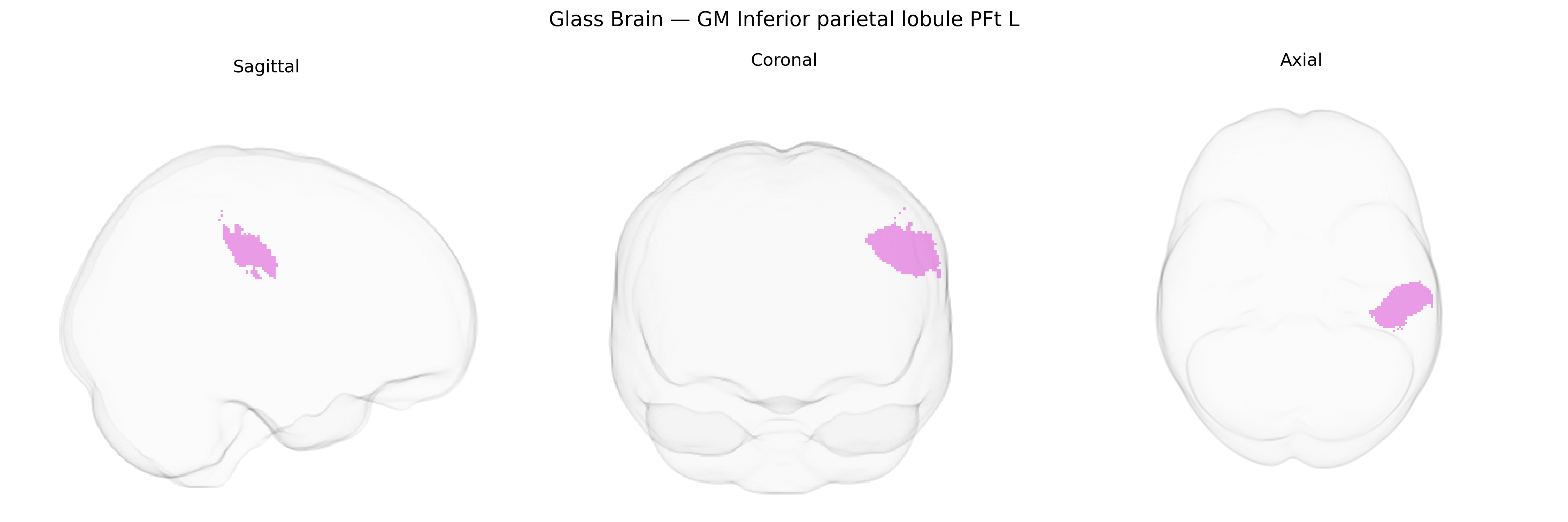 Triplanar Ghost Brain