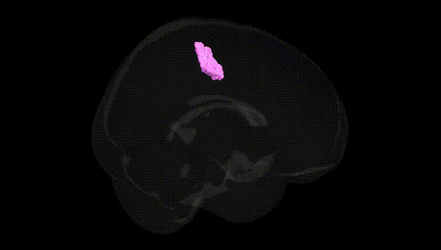 Full Brain Black