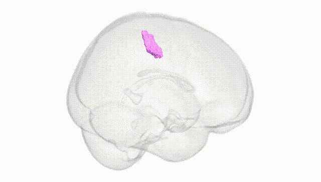 Full Brain White