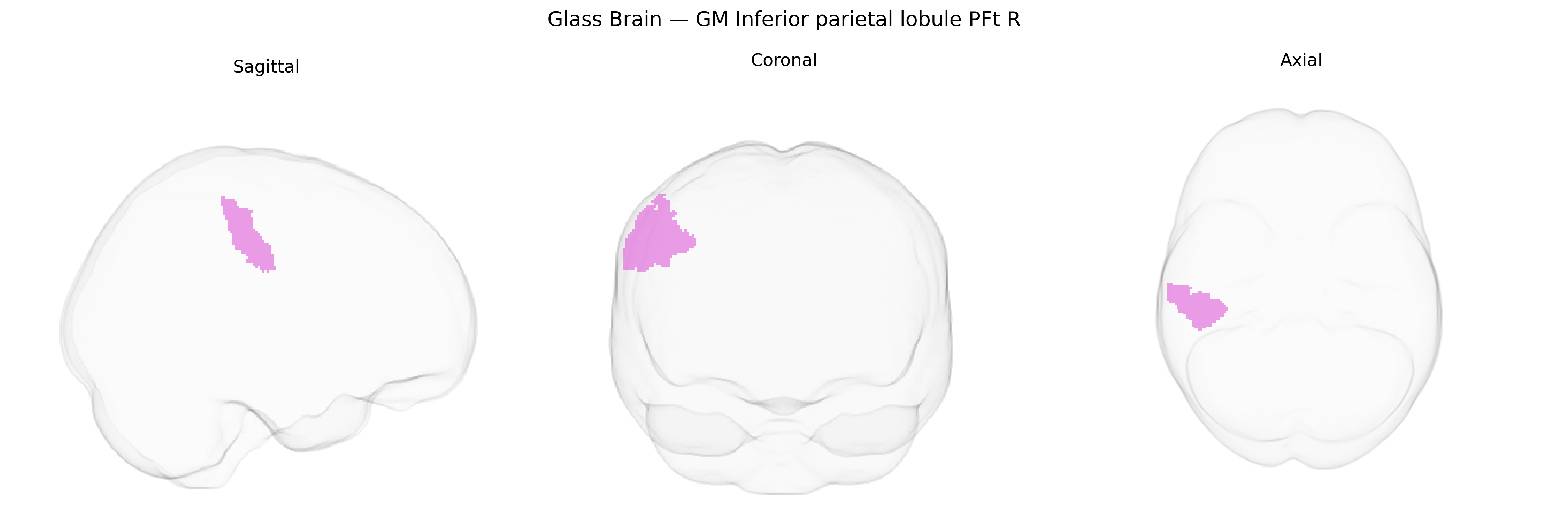 Triplanar Ghost Brain