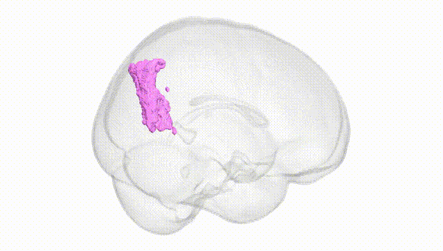 Full Brain White
