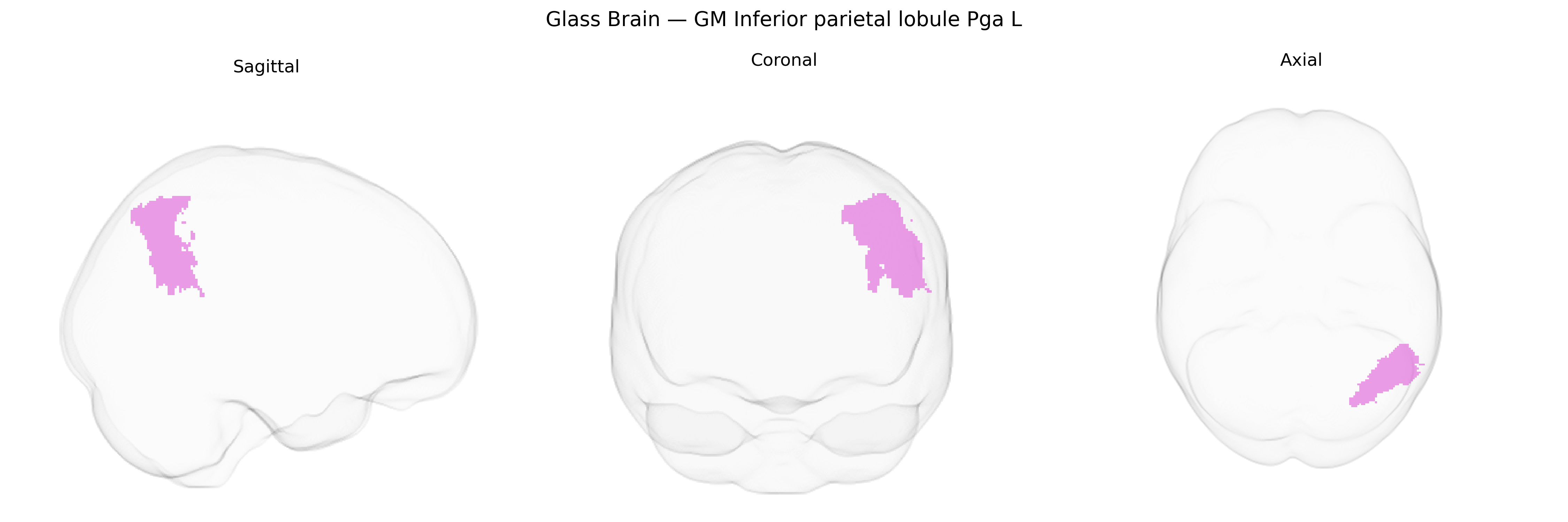 Triplanar Ghost Brain