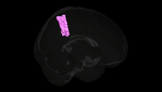 Full Brain Black
