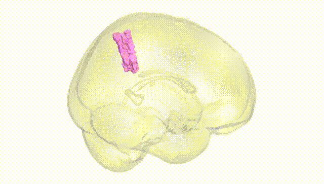Full Brain White