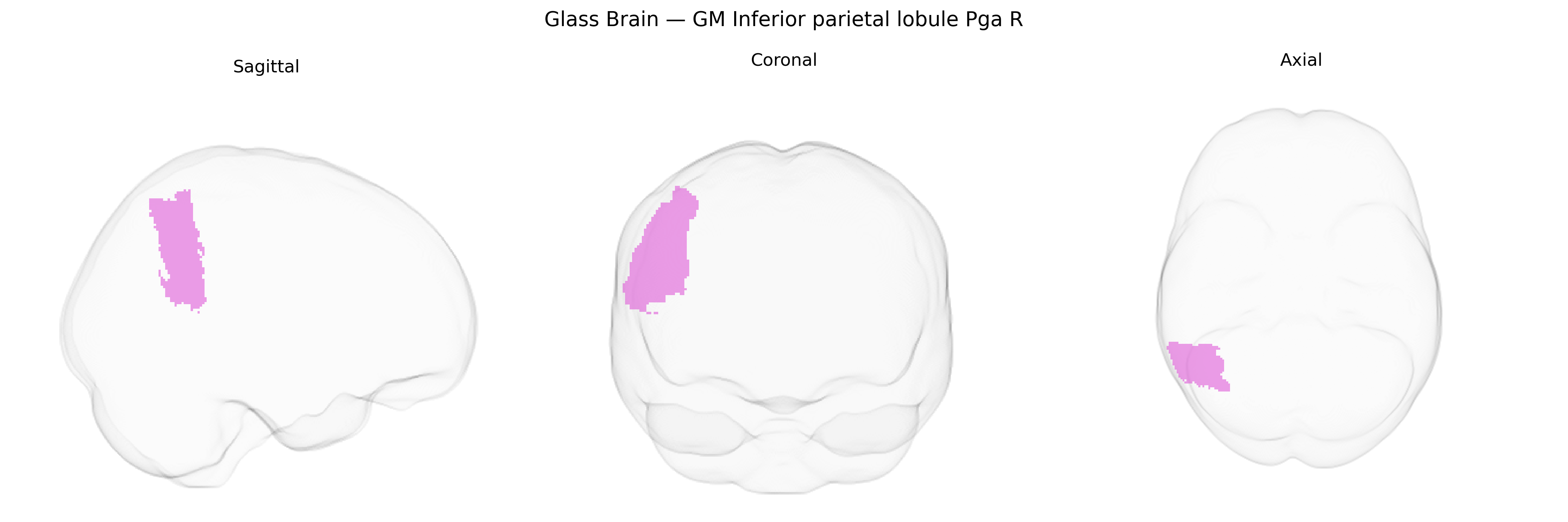 Triplanar Ghost Brain