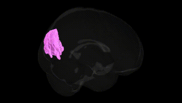 Full Brain Black