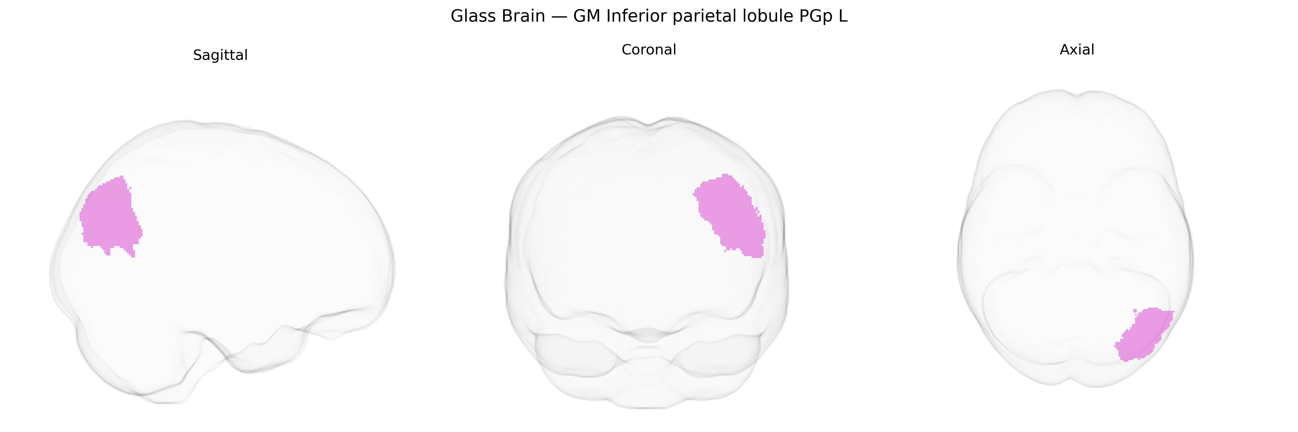 Triplanar Ghost Brain