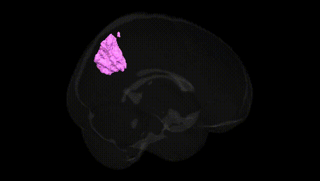 Full Brain Black
