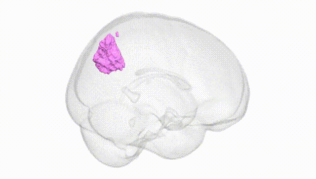 Full Brain White