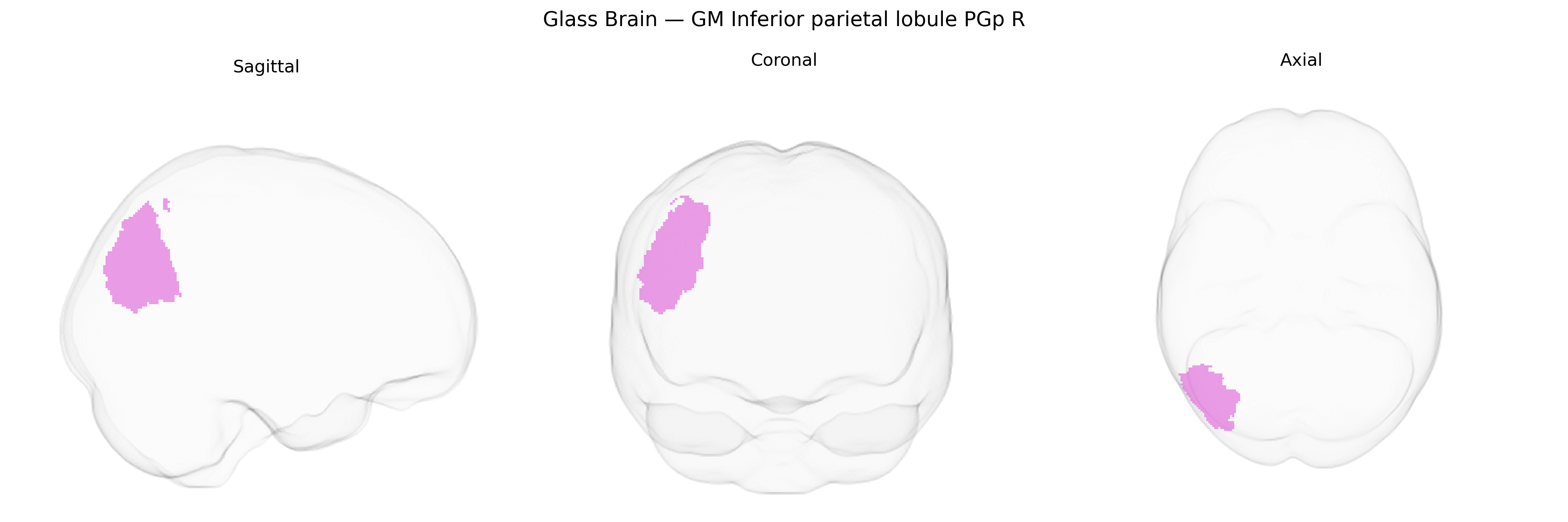 Triplanar Ghost Brain