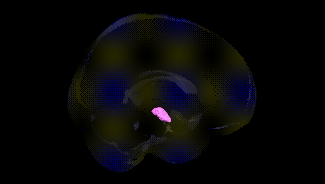 Full Brain Black