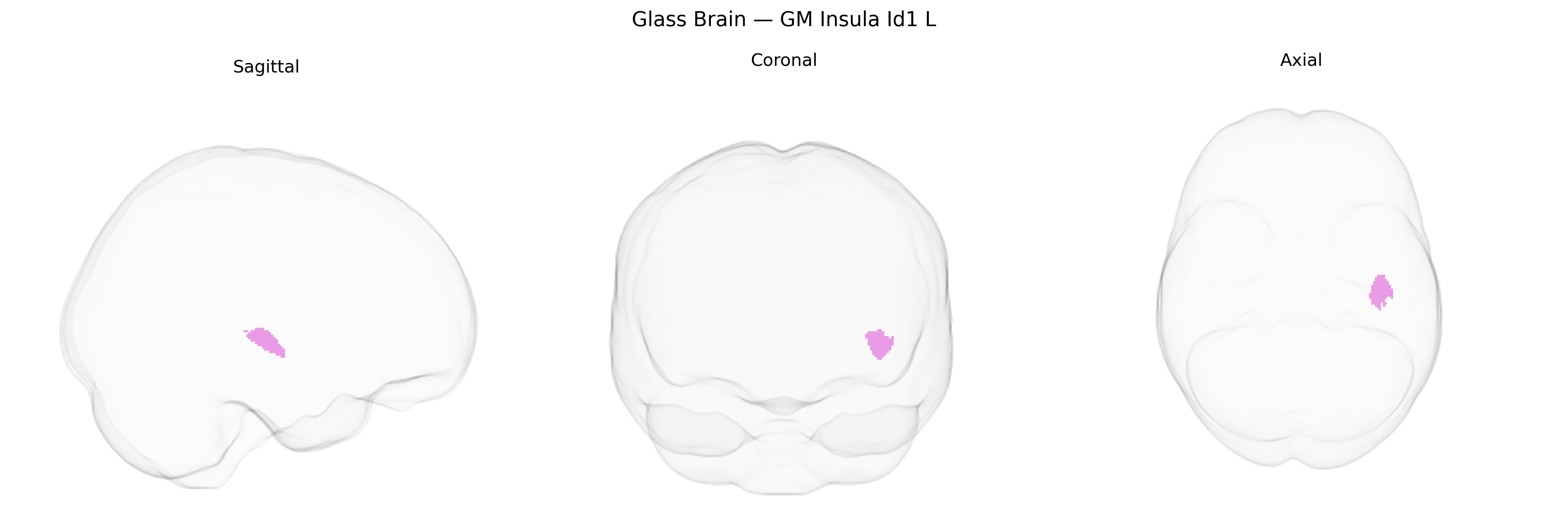 Triplanar Ghost Brain