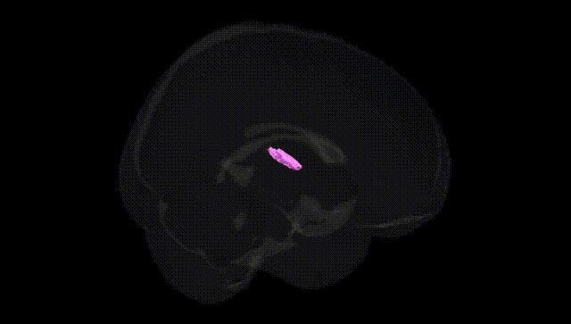 Full Brain Black