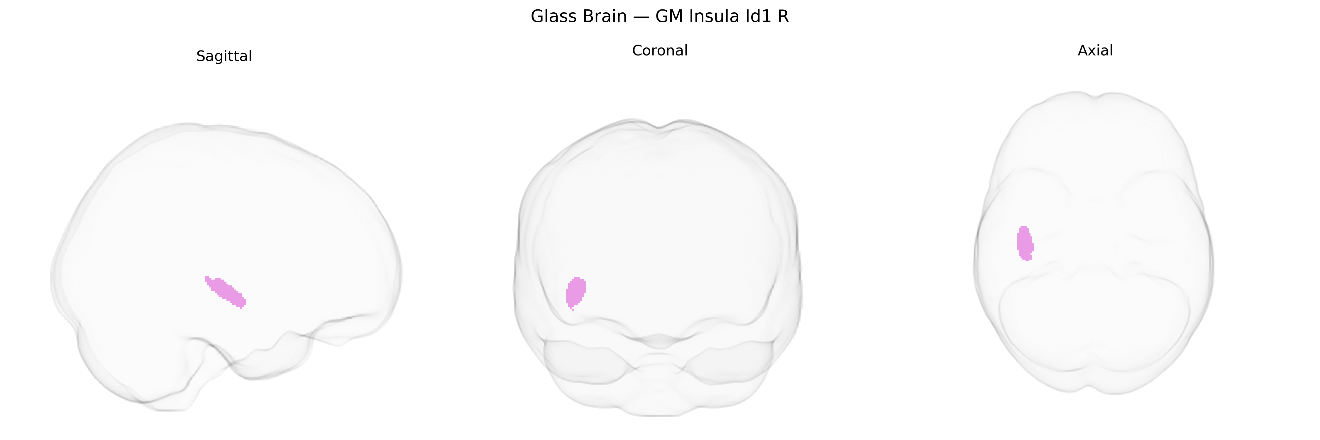 Triplanar Ghost Brain