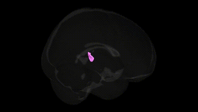 Full Brain Black