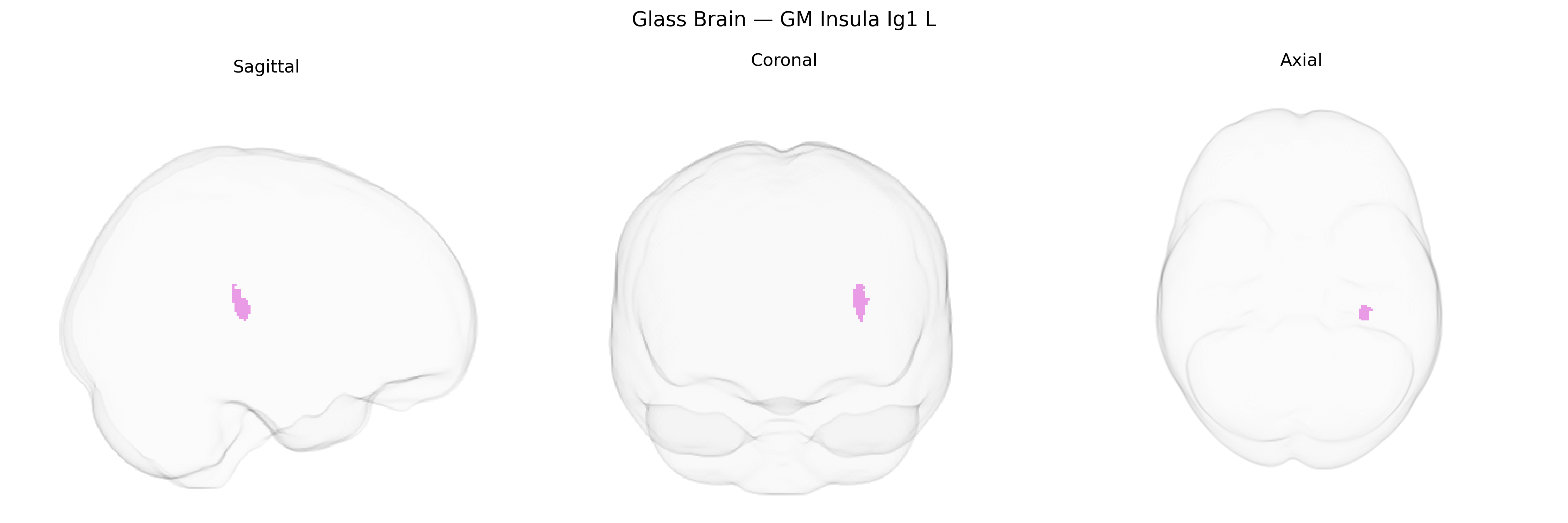 Triplanar Ghost Brain
