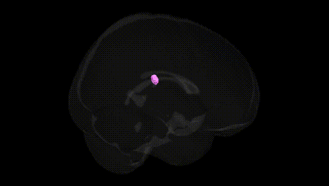 Full Brain Black