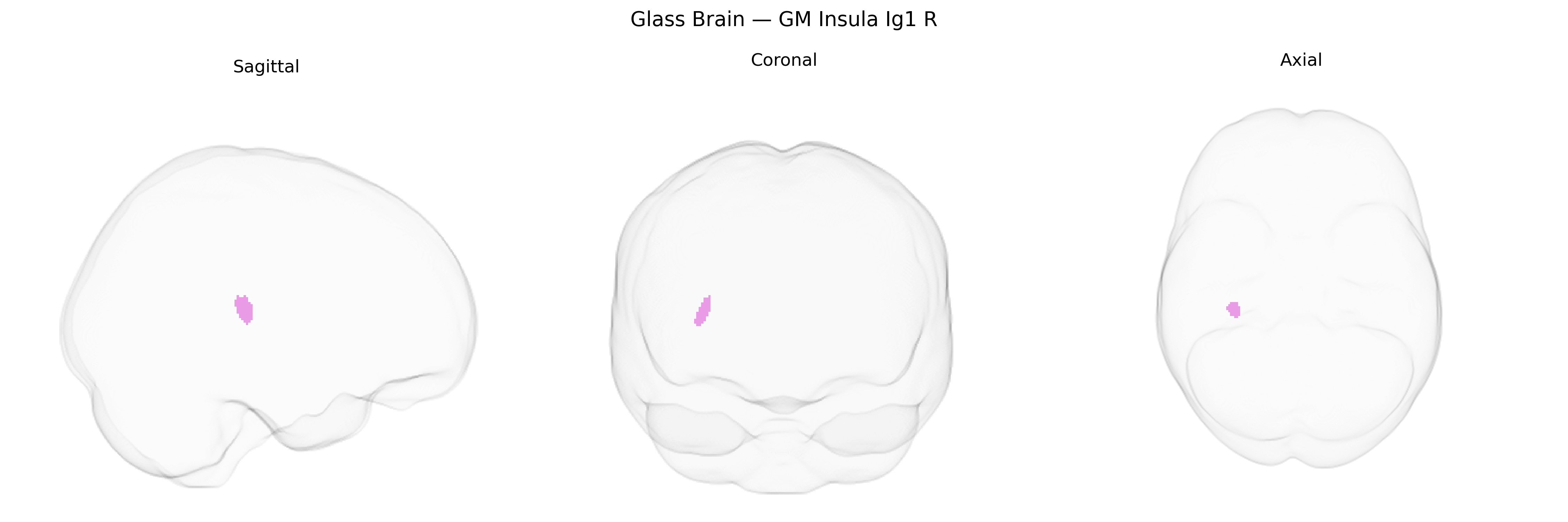 Triplanar Ghost Brain