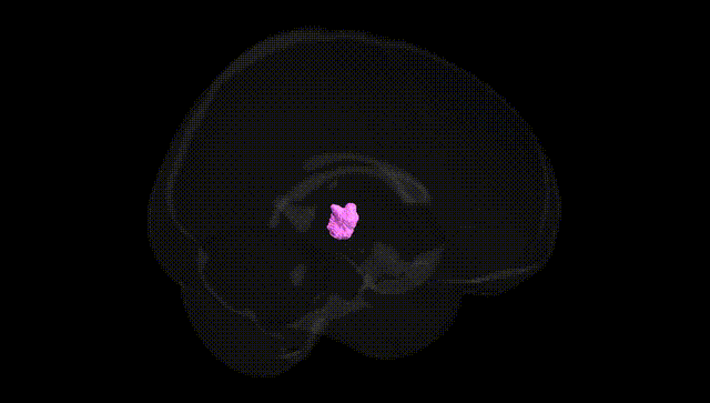 Full Brain Black