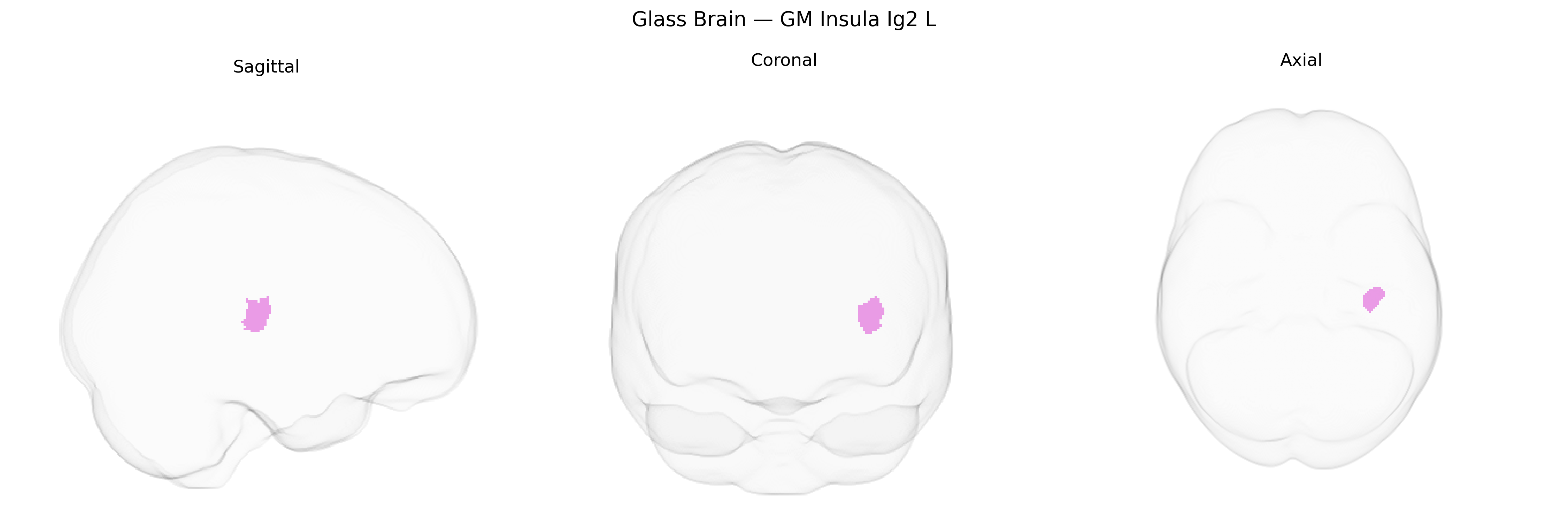 Triplanar Ghost Brain