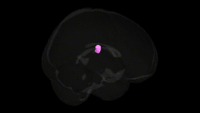 Full Brain Black