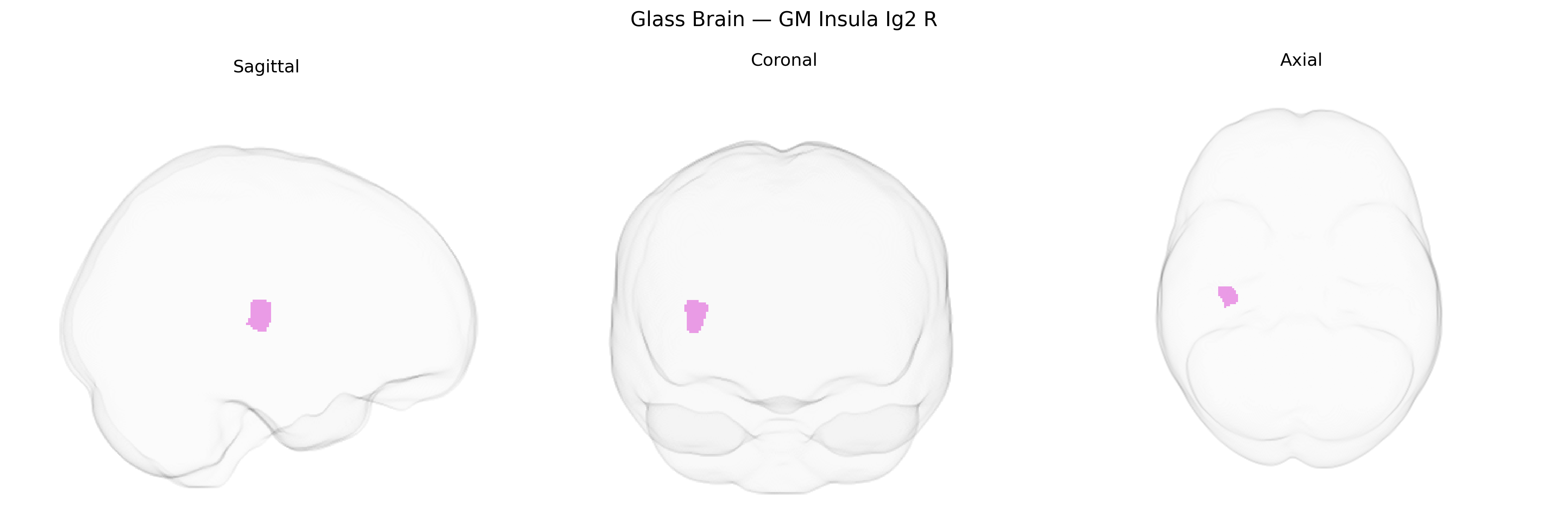 Triplanar Ghost Brain