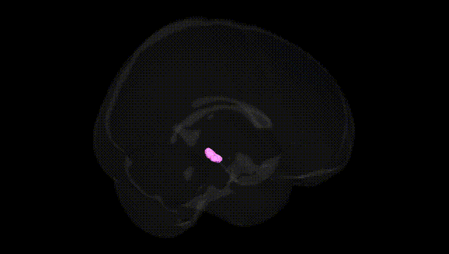 Full Brain Black