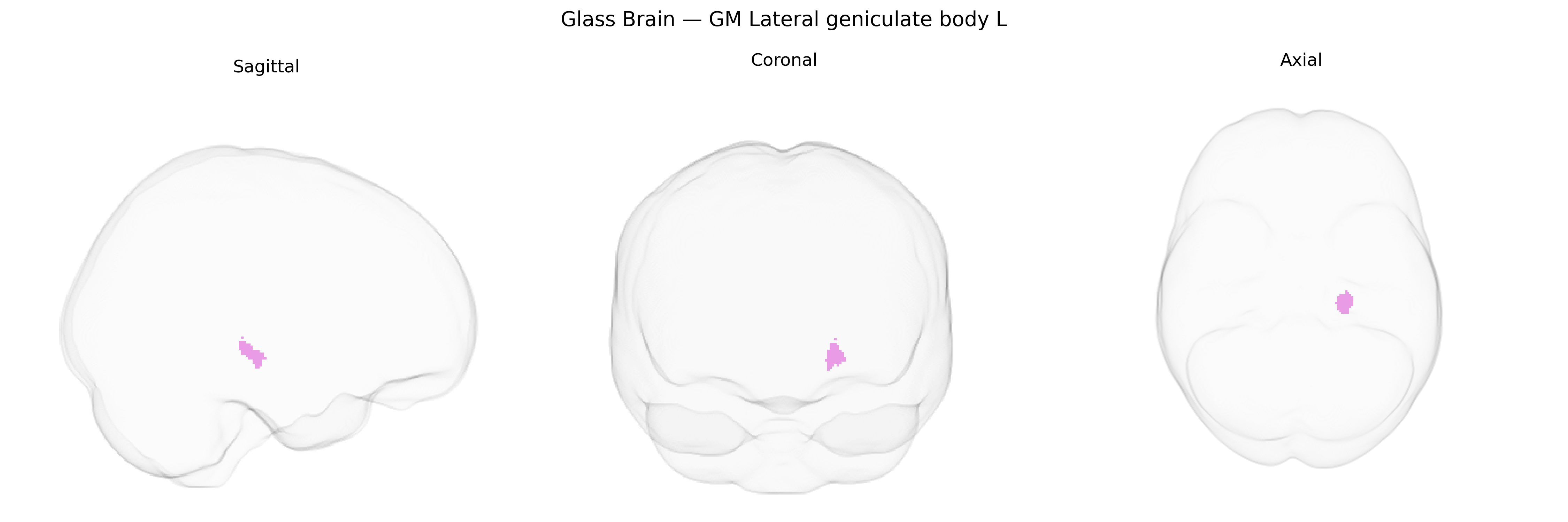 Triplanar Ghost Brain