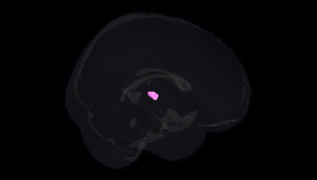 Full Brain Black