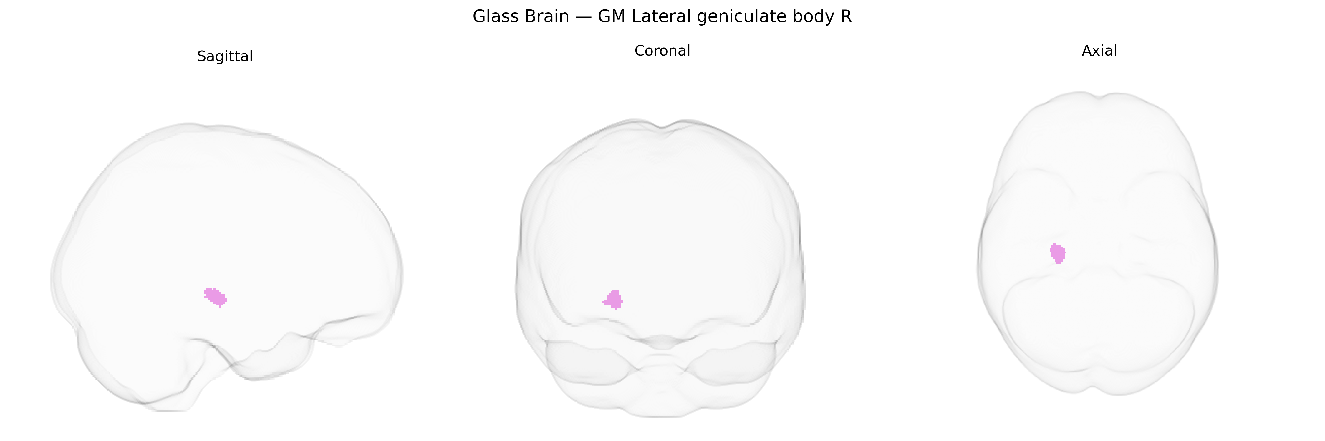 Triplanar Ghost Brain