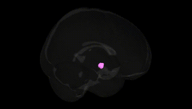 Full Brain Black