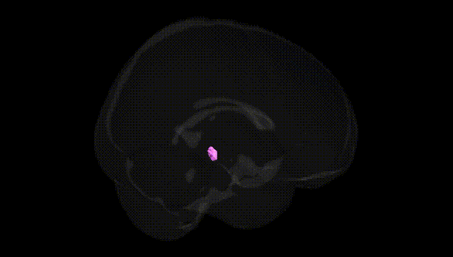 Full Brain Black