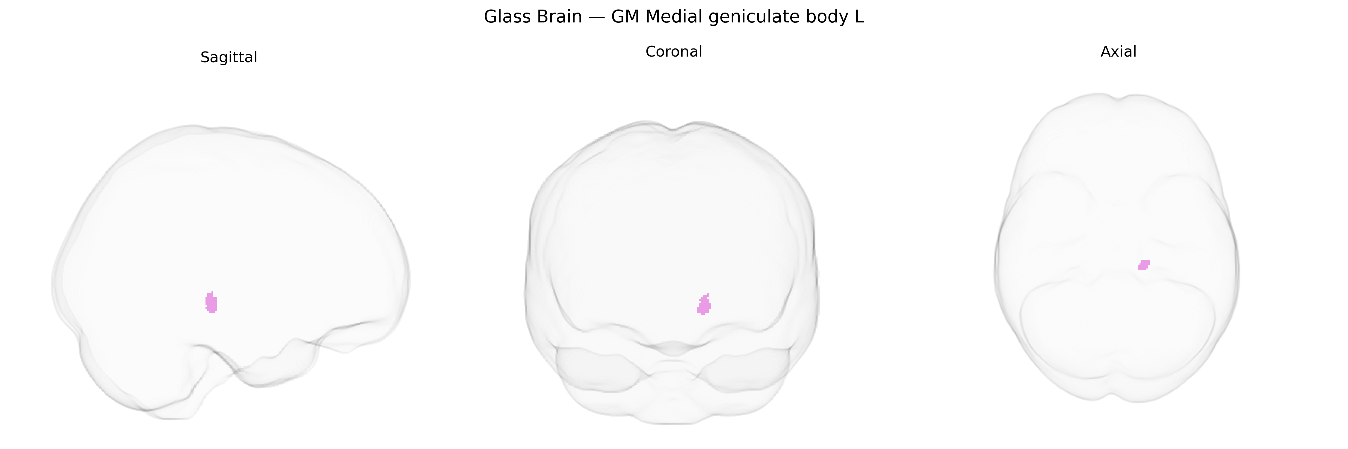 Triplanar Ghost Brain