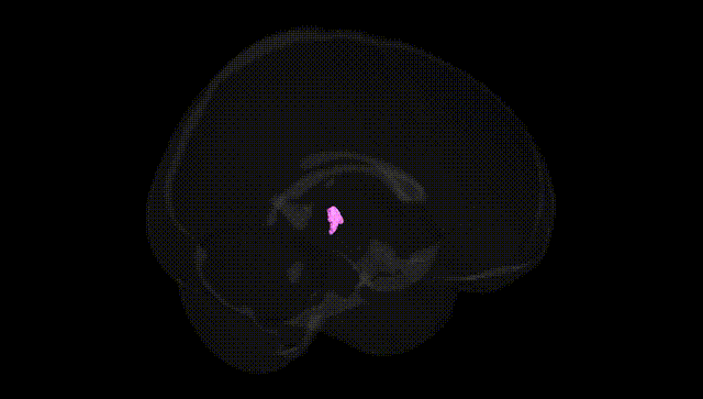 Full Brain Black