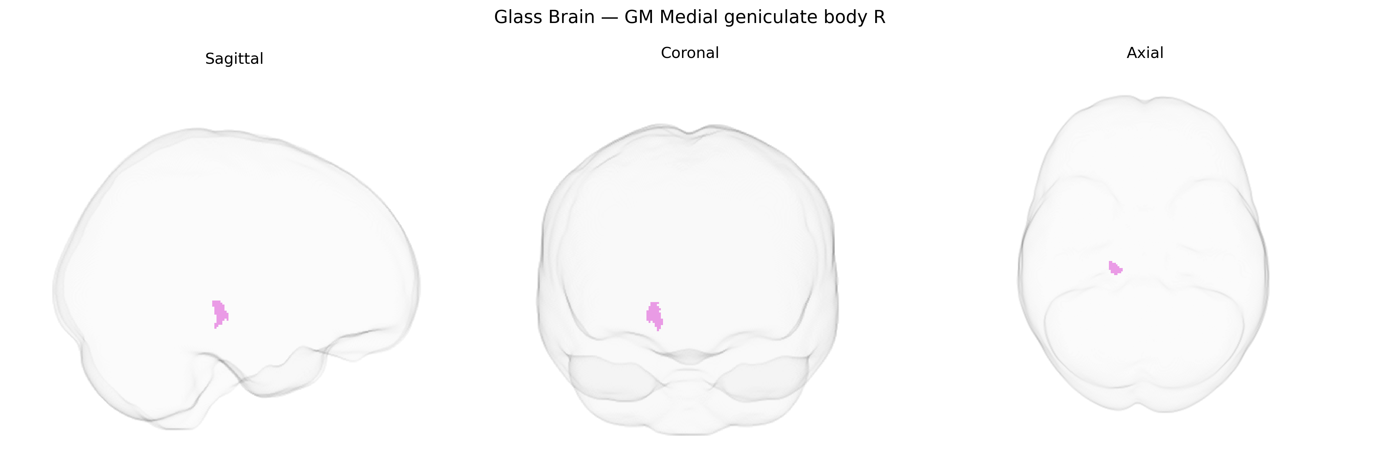 Triplanar Ghost Brain