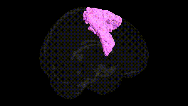Full Brain Black