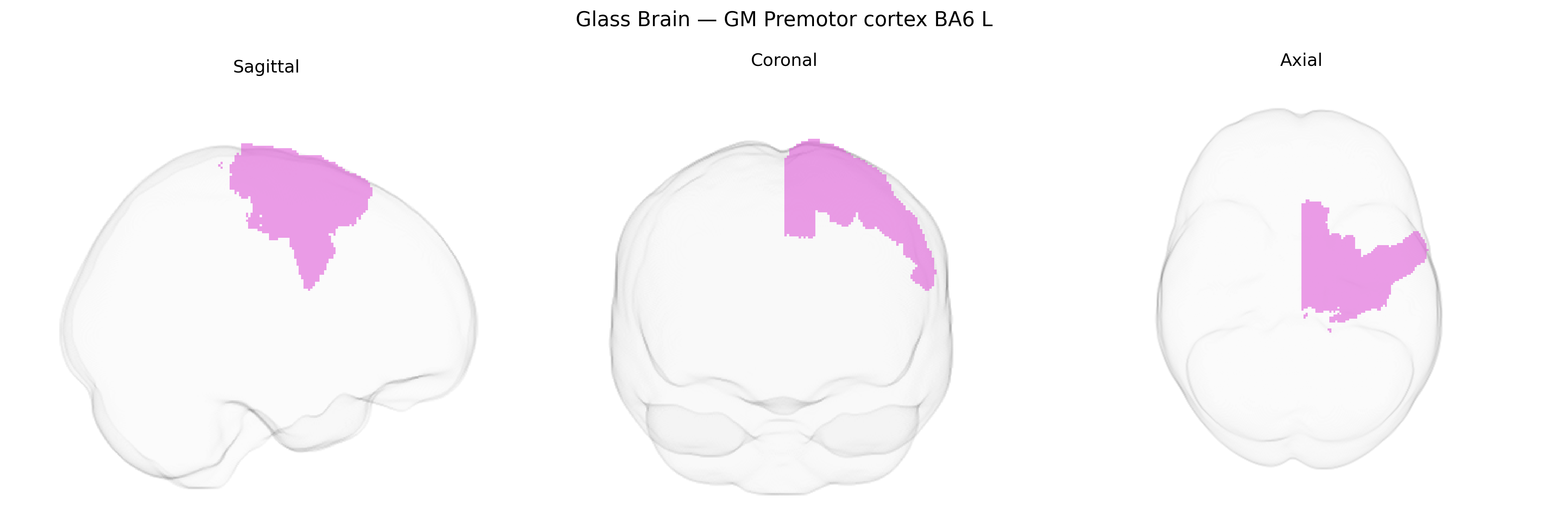 Triplanar Ghost Brain