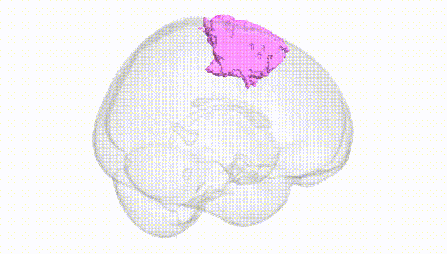 Full Brain White