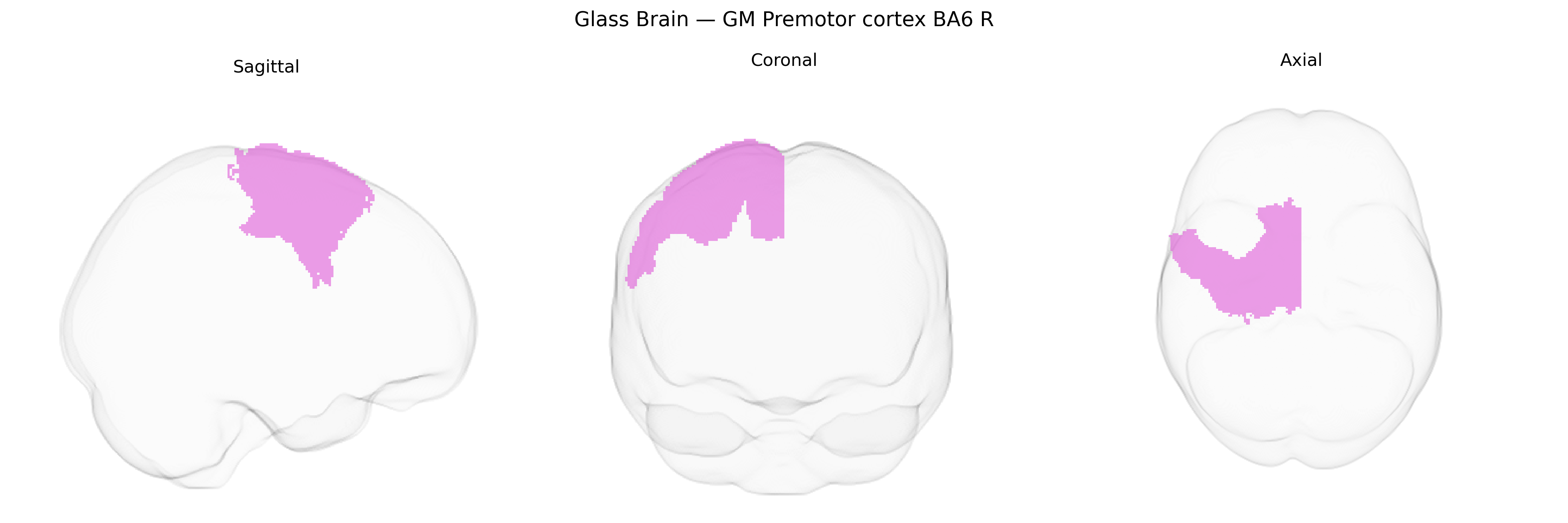 Triplanar Ghost Brain