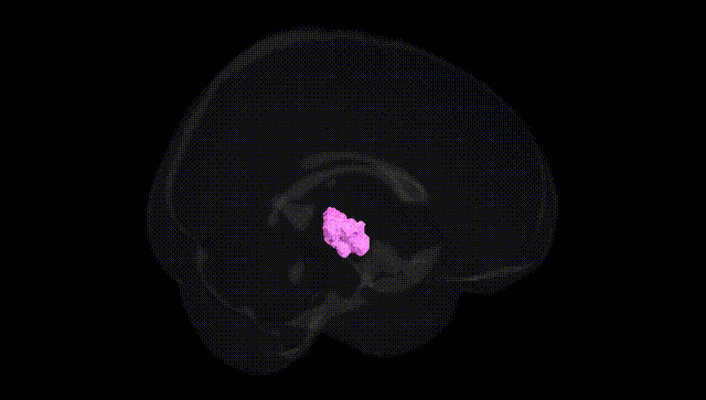 Full Brain Black