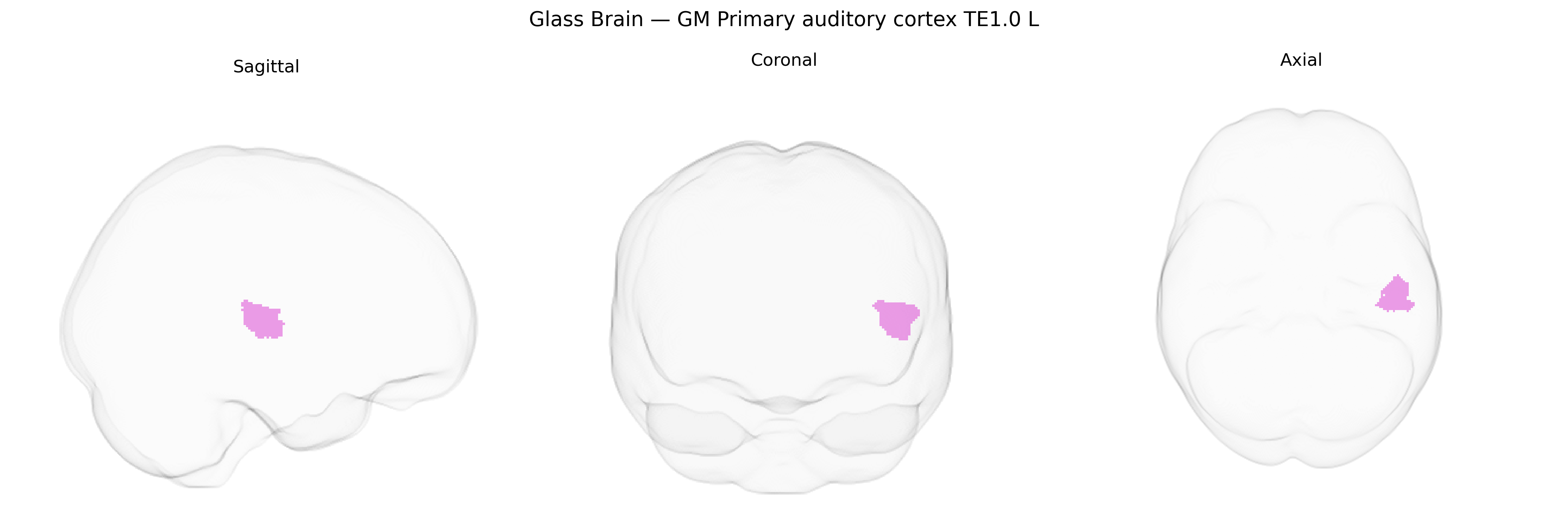 Triplanar Ghost Brain