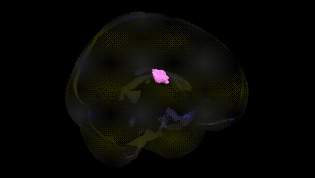 Full Brain Black