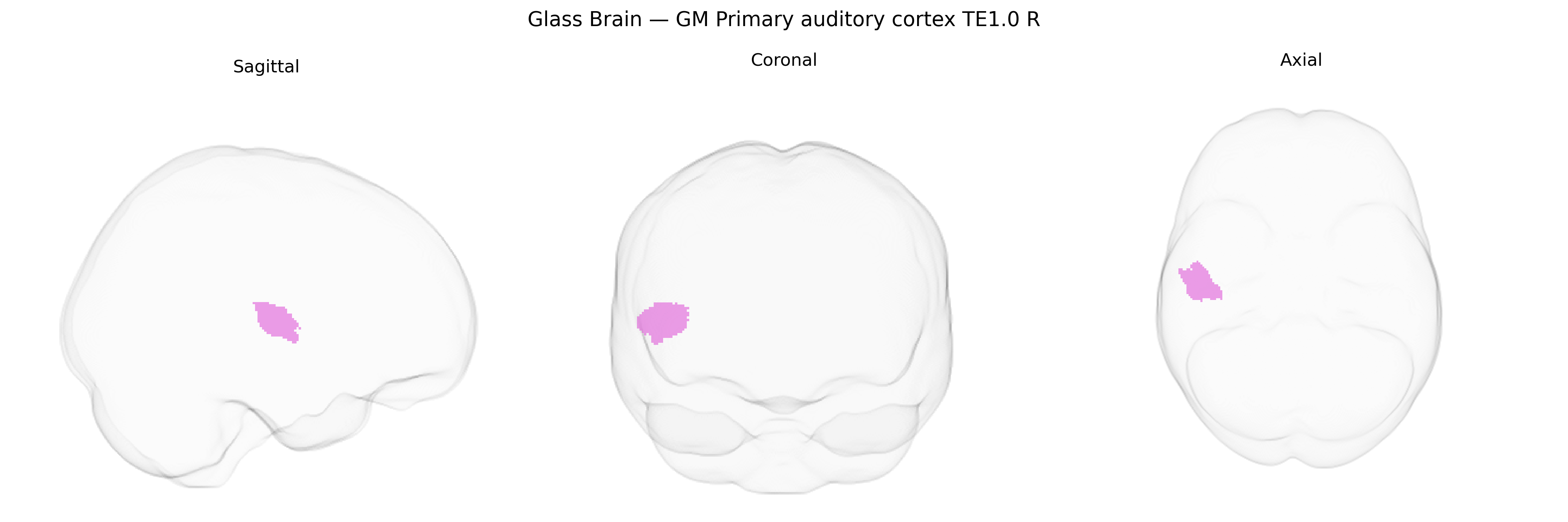 Triplanar Ghost Brain