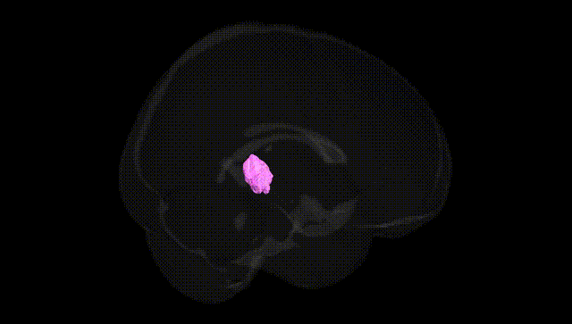 Full Brain Black