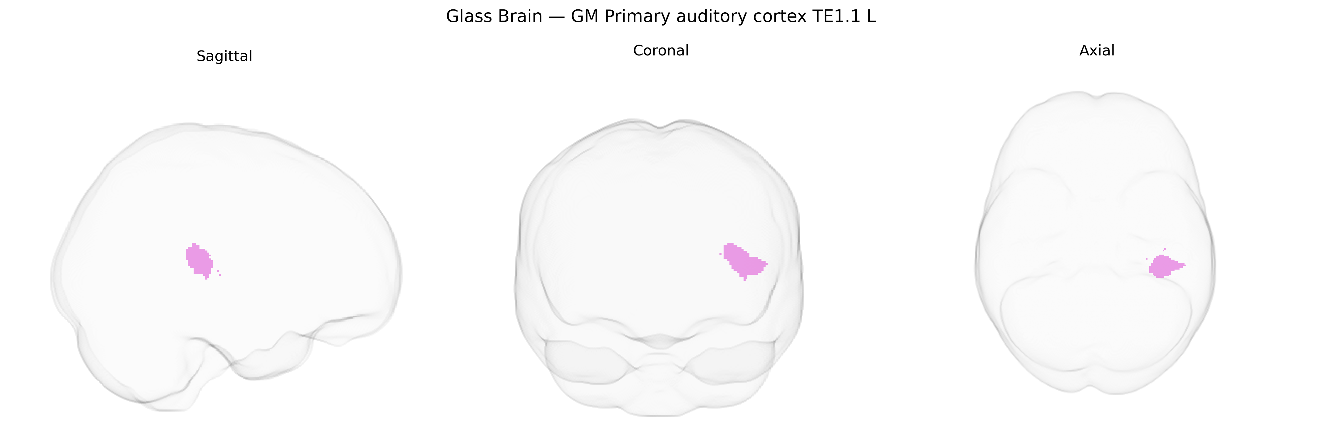 Triplanar Ghost Brain