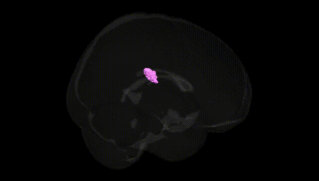 Full Brain Black