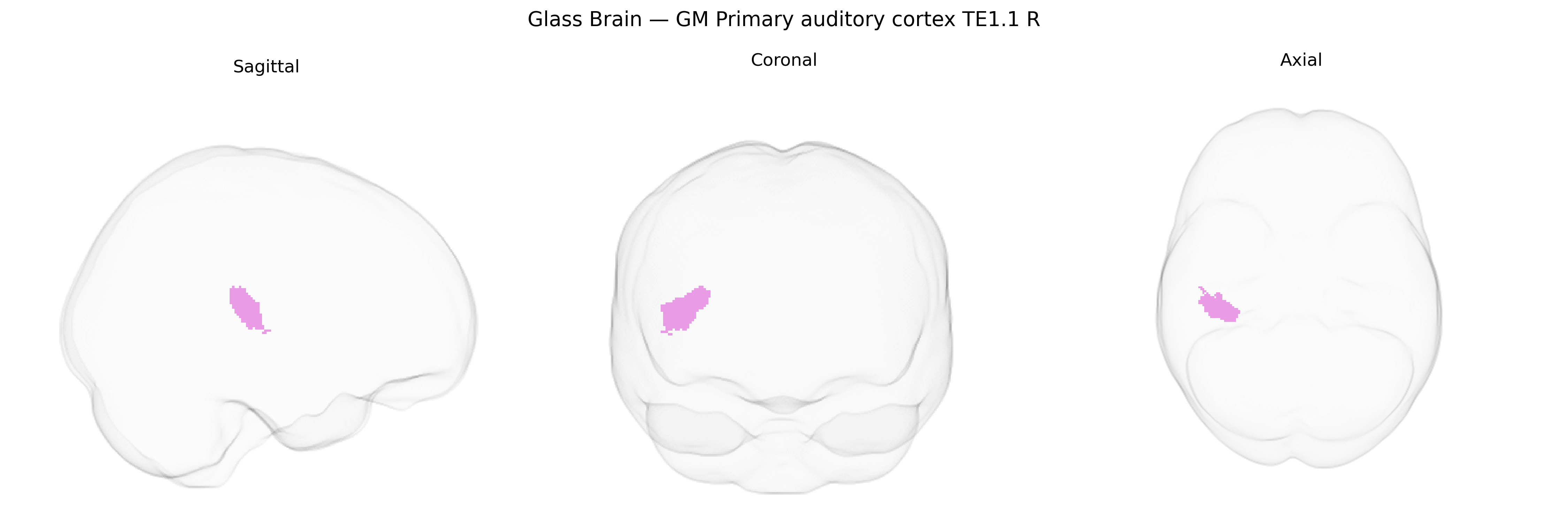 Triplanar Ghost Brain