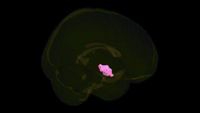 Full Brain Black