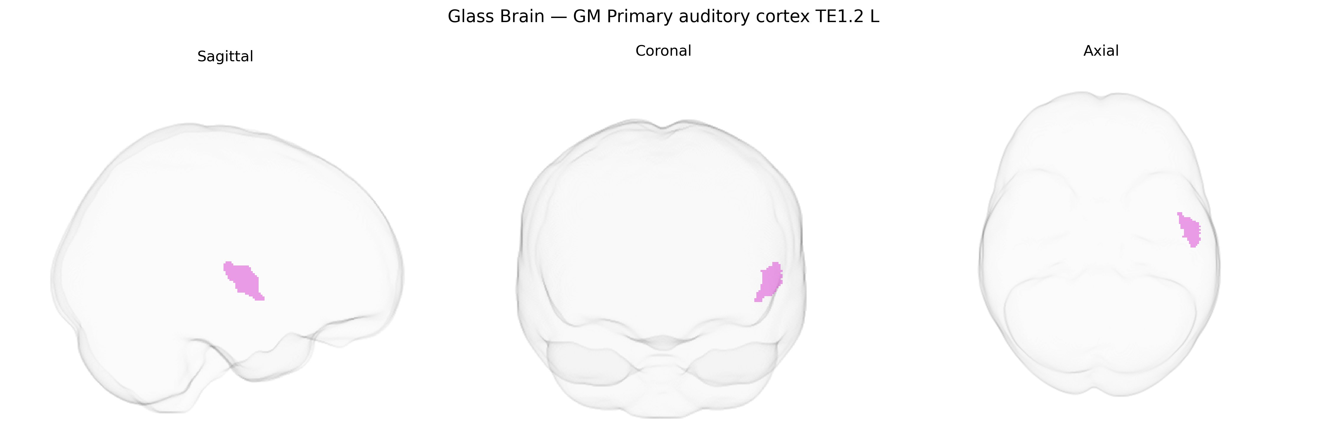 Triplanar Ghost Brain